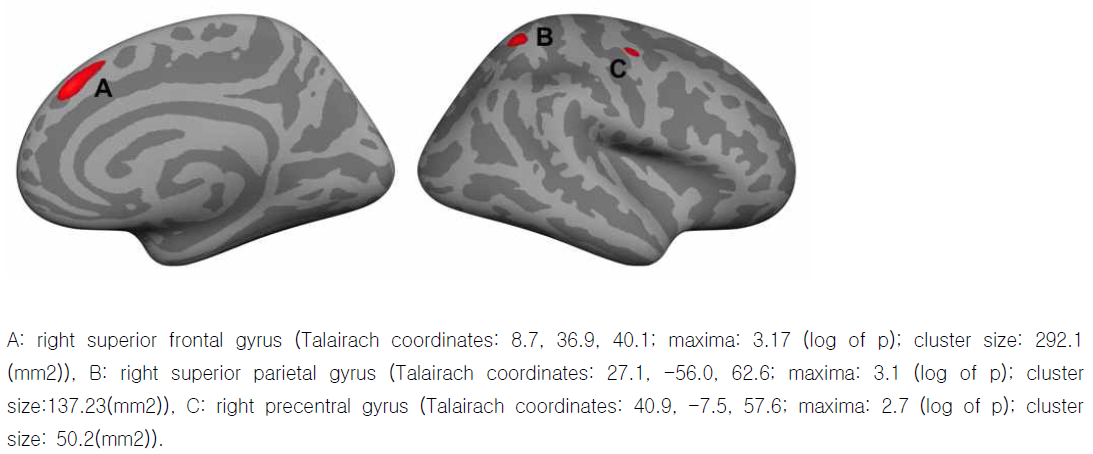 Brain regions which was associated with career length of the pro-gamers