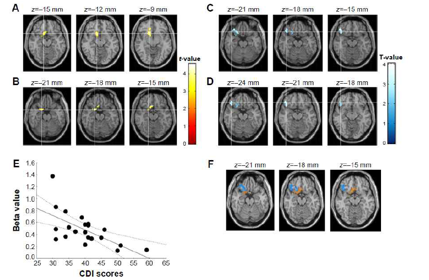 Affective network in depressive adolescents with disruptive behaviors