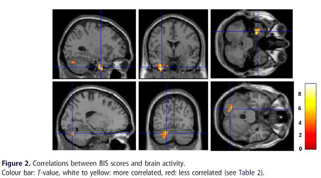 Correlations between BIS scores and brain activity.