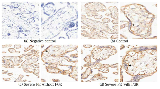 The localization of PMCA in placentas by immunohistochemistry.