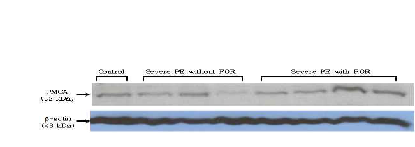 Representative Western blot and densitometric analysis of PMCA in placentas with control group and severe PE with or without FGR groups.