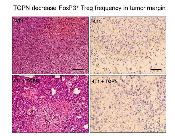 4T1 유방암 세포주를 intraductal injection한 후 TOPN을 복강내 주사하면 종양 변연부의 FoxP3+ Treg 빈도가 감소되어 종양에 대한 면역반응이 항진되었음을 시사함