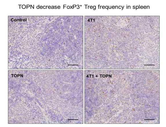 4T1 세포주를 주사하여 유방암을 유발시키면 비장의 FoxP3+ Treg 빈도가 증가되어 전신적인 면역반응이 약화됨