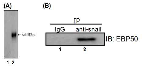 EBP50 항체를 사용하여 snail 결합 단백질 복합체의 웨스턴 분석결과