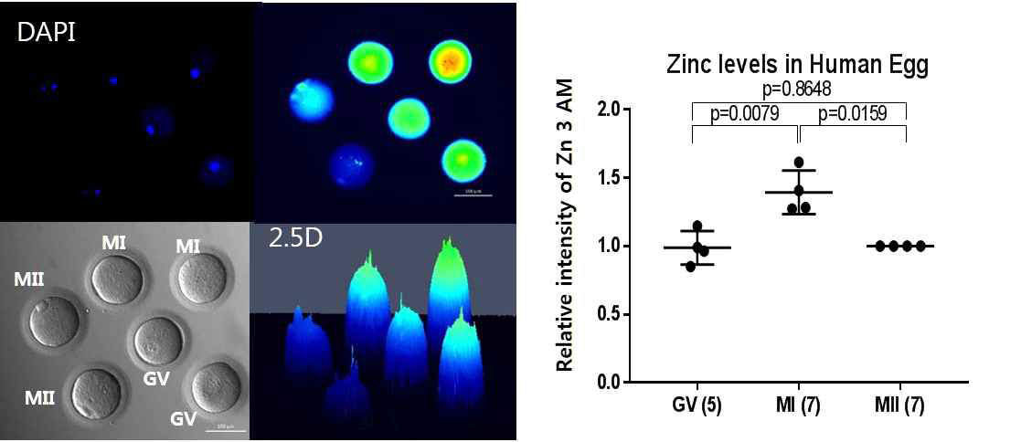 사람 난자 성숙 단계에 따른 세포질 내 zinc ion level 변화