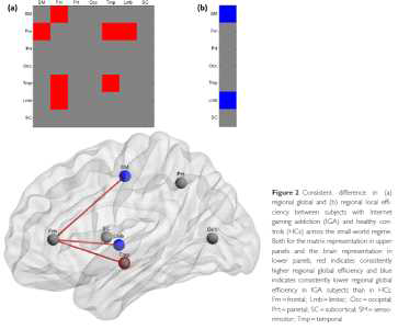 인터넷 게임 중독의 병적인 대뇌 연결성