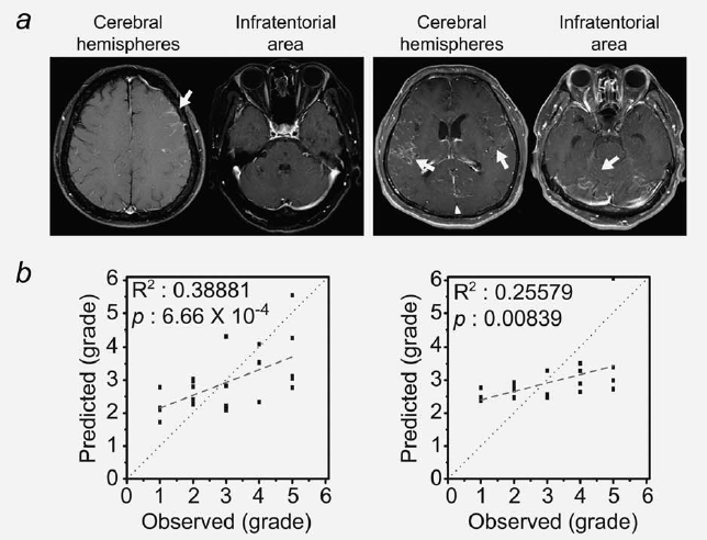 1단계와 5단계 leptomeningeal carcinomatosis 환자의 MRI 데이터 (b) 관찰값과 예측값 사이의 correlation plot