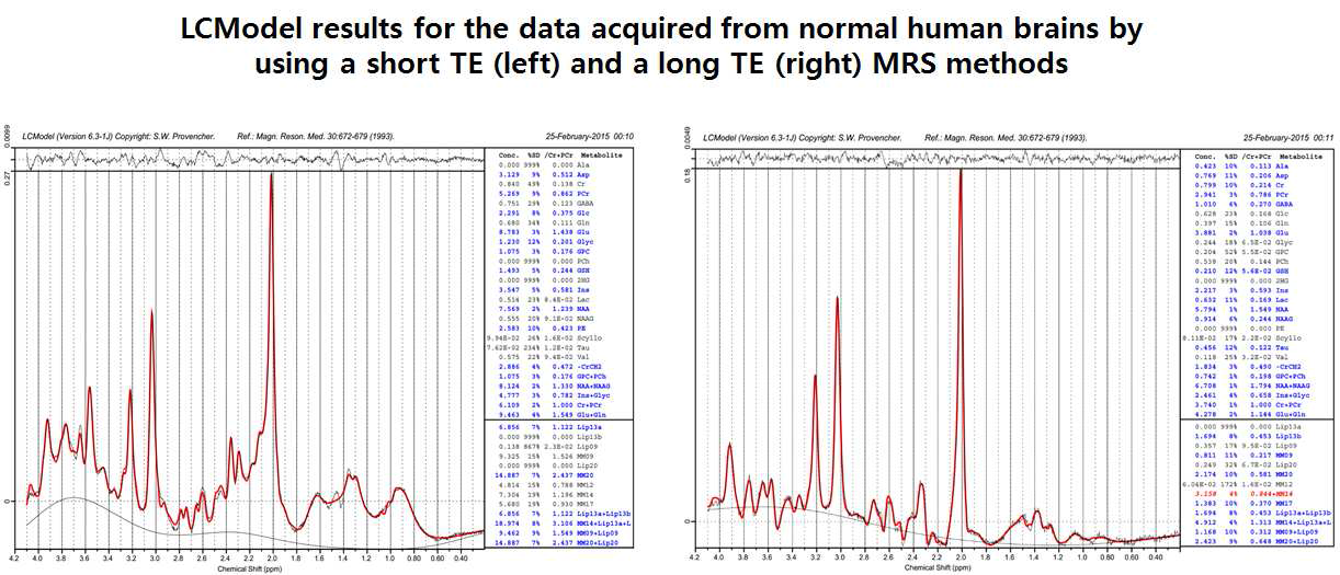 정상 자원자들의 뇌에서 비침습적으로 얻은 스펙트럼들. (죄측) short TE MRS 기술, (우측) long TE MRS 기술. 본 예에서는 LCModel 이라는 MRS 분석용 프로그램을 이용하여 스펙트럼을 분석하였으며, 약 20 여종의 대사체들에 대한 정량분석 결과 (각 스펙트럼 좌측 박스)를 얻을 수 있음.