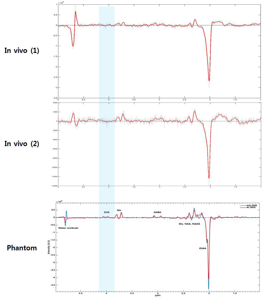 정상 자원자의 뇌에서 얻어진 스펙트럼들 (In vivo (1)과 In vivo (2)) 과 2HG를 포함하는 대사체 용액으로 부터 얻어진 스펙트럼 (Phantom) 과의 비교.