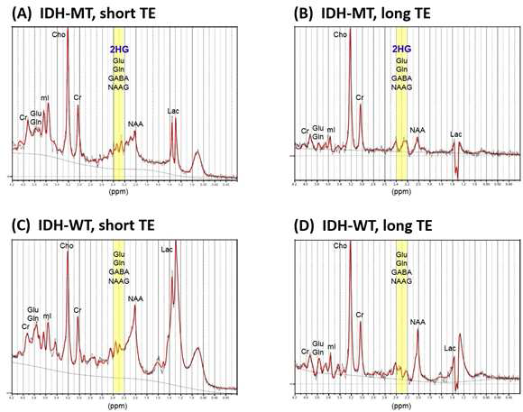 IDH 변이가 있는 뇌종양 환자 (A, B)와 변이가 없는 뇌종양 환자 (C, D)의 뇌종양 부위에서 얻어진 스펙트럼의 예. 모든 환자에 대해 short TE와 long TE 펄스 시퀀스를 이용하여 데이터를 얻었으며 본 그림에서는 LCModel을 이용하여 대사체 정량분석을 시행한 예를 보여줌.