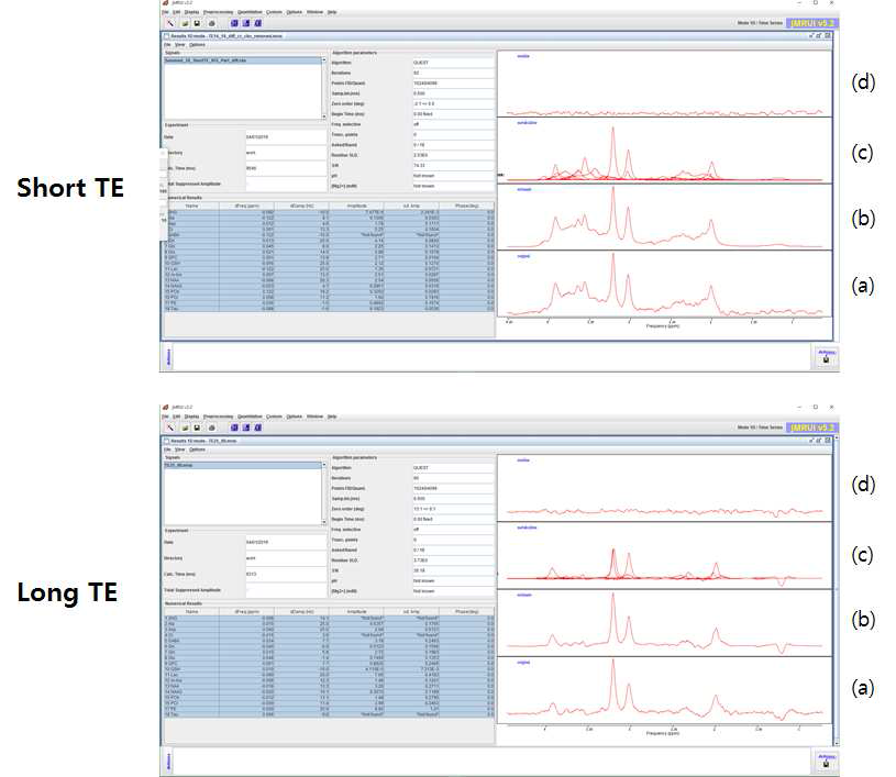 Short TE 와 long TE MRS 펄스 시퀀스를 이용하여 얻어진 데이터를 MRUI 소프트웨어로 분석한 결과의 예.