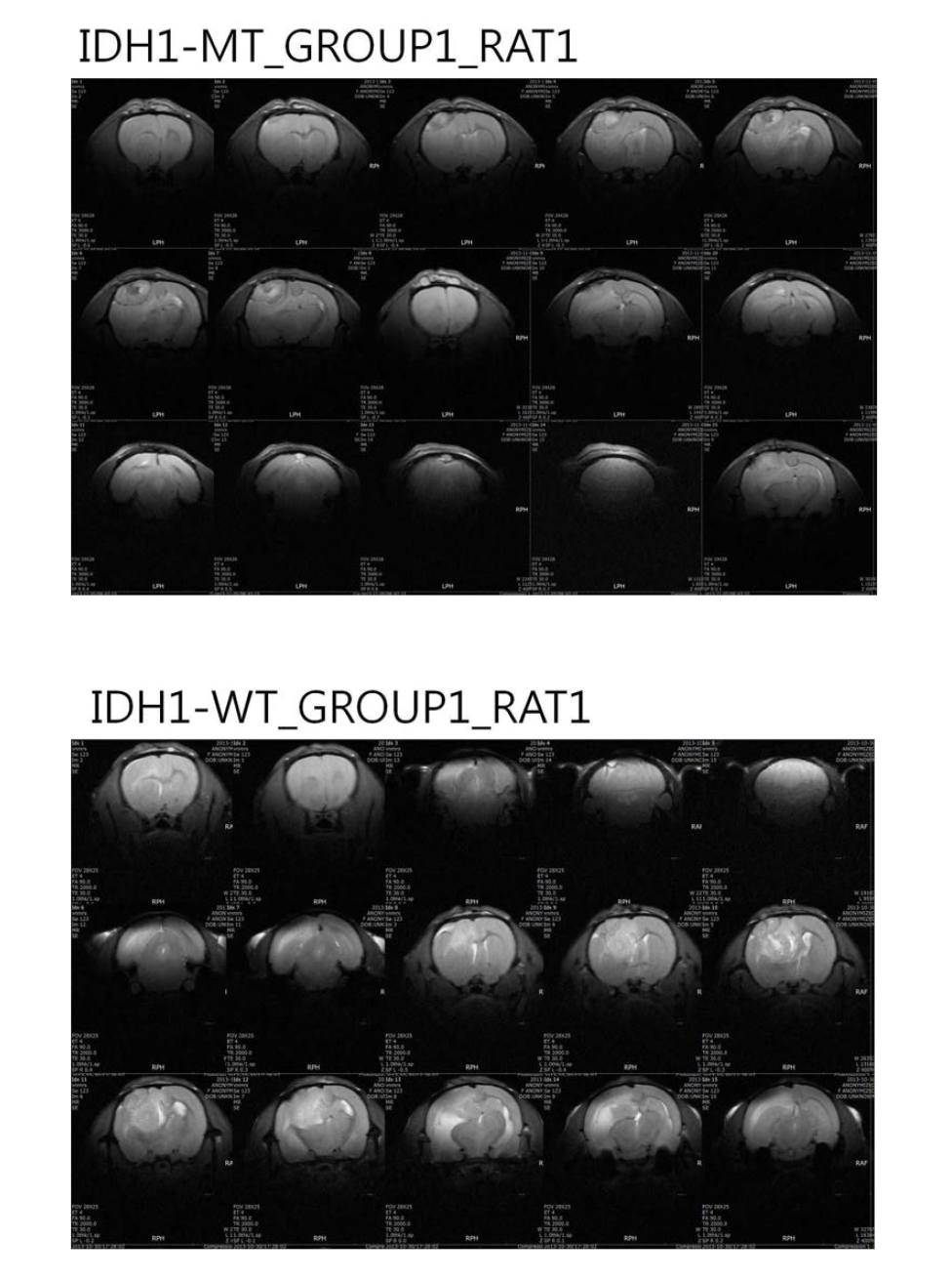 MRS study를 목적으로 IDH mutation expressing F-98 cell를 만든후, 이를 이용한 tumorogenesis 실험. IDH mutation cell line을 이용하여 in vivo IDH mutation tumor (F-98) rat model을 제작함. 이를 이용하여 in vivo metabolite 측정 실험을 3세부와 진행함.