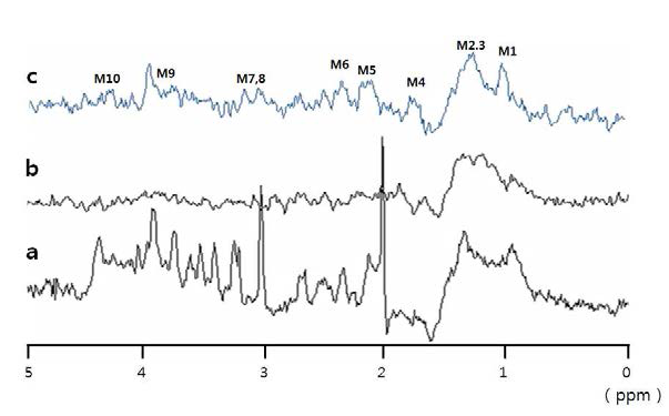 본 연구진이 얻은 (a) 최소 검출 시간 조건하 생체 내 MRS 스펙트럼, (b) 단일 반전