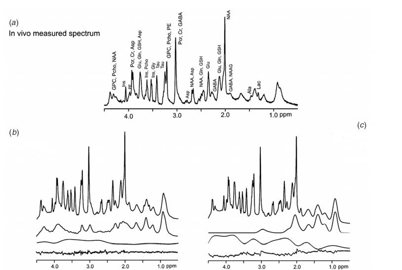 최소검출시간 조건으로 얻어지는 고해상도 생체 MRS 스펙트럼 (a). 거대분자의 공명현상 정보를 얻기 위한 두 가지 접근 방법 (b, c). (a) 최소검출시간 조건으로 얻어지는 MRS 스펙트럼에는 대사체들의 공명 정보와 더불어 생체내에서만 특이적으로 나타나는 거대분자의 공명 정보가 내포되어있음. (b) 반전 회복 시퀀스를 이용하여 거대분자의 정보를 따로 획득함. (c) 실험에서 얻어진 MRS 스펙트럼 내에서 수학적 모델링을 통해 거대분자의 정보를 내부적으로 산정함.