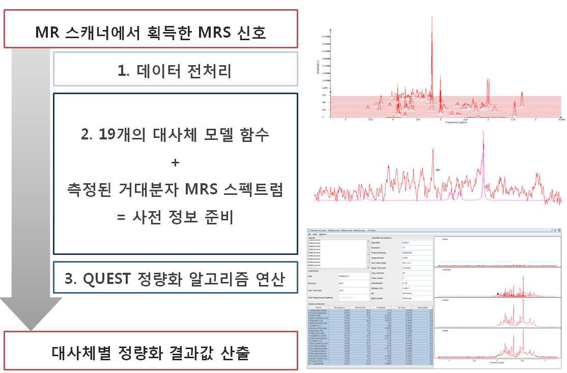 jMRUI-package를 이용한 대사체별 정량화 결과 값 산출 과정 및 구성 요소