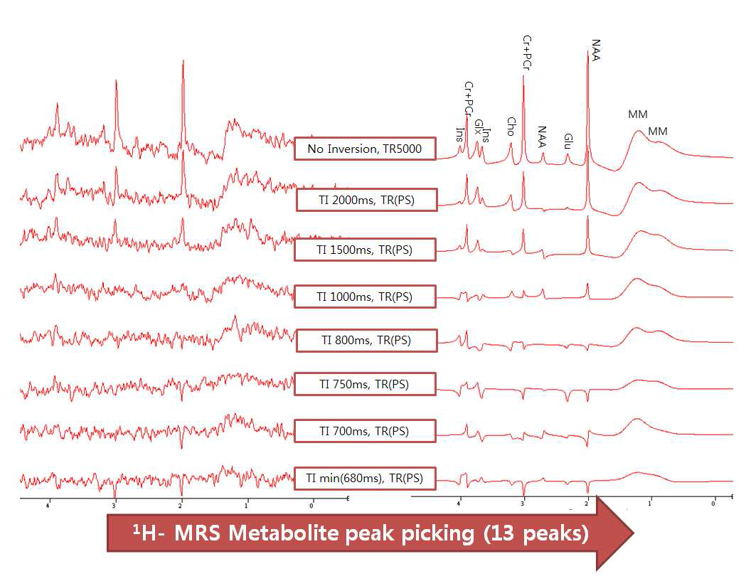 생체 내에서의 이중반전회복 시간 파라미터의 최적화 검증 과정. 단일 반전 이완법 및 부분분리 기술을 이용하여 TI2값을 최적화 하였음. 생체 내 최적화에서는 긴 검출 시간 조건을 이용하였기 때문에, 신호의 수율이 높지 않은 단점이 있음. 따라서 정확한 대사체 반전정보를 확인하기 위하여, 13개의 주요 대사체 공명 신호만 선택하는 후처리를 적용하였음.