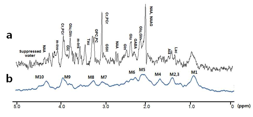 동일한 두뇌 부위에서 얻어지는 시퀀스별 MRS 스펙트럼. 최소검출시간(minimum echo time) 조건의 시퀀스로부터 얻은 대사체 MRS 스펙트럼, 각 대사체 신호 아래에는 거대분자의 신호가 포함되어있음 (a). 이젓 반전 회복 기술을 이용한 동일 부위 내에서의 거대분자 MRS 스펙트럼, 실험방법에서 기술된 시간 파라미터 최적화 과정을 통해 최종적으로 총 10개의 공명 현상을 나타내는 거대분자 신호를 얻었음 (b).