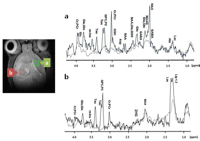 동일한 랫드에서 부위 별로 획득한 일반적인 MRS 스펙트럼.
