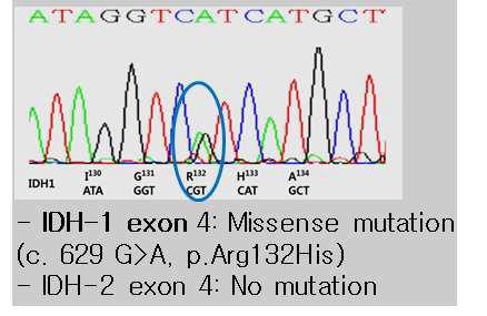 IDH1 돌연변이를 나타내는 대표적인 조직의 염기서열분석.