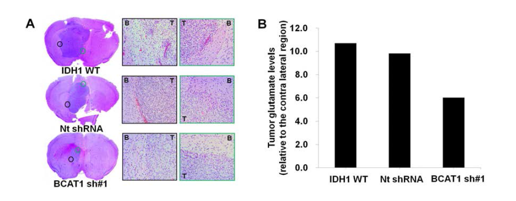 In vivo에서 BCAT1이 억제 된 cell line의 특성 분석. (A) 마우스 뇌종양모델에서 뇌종양 형성능 및 침습력 분석. (B) 랫 뇌종양모델에서 glutamate level 측정