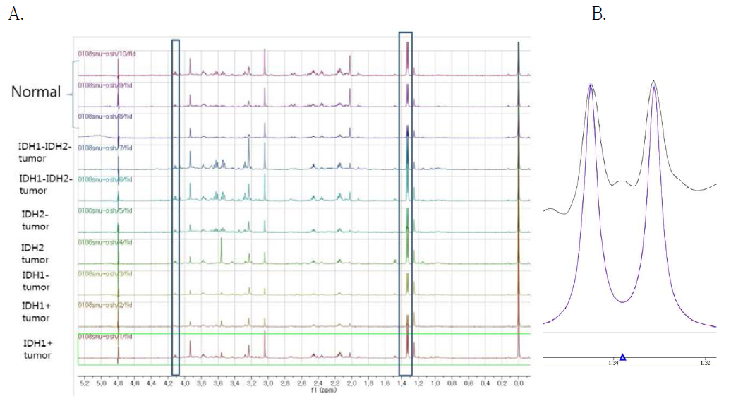 A.뇌암과 정상조직의 일차원적 NMR data에서의 lactate의 농도 비교. B. lactate 확인 (1.3 ppm)