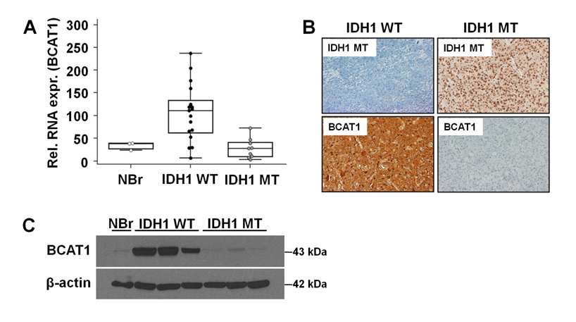 뇌종양 환자 조직에서의 BCAT1 level 확인. (A) qRT-PCR (B) 병리검사 (C) Western Blot