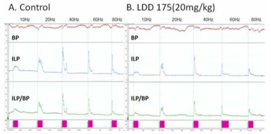 LDD 175가 정낭 내압에 미치는 영향