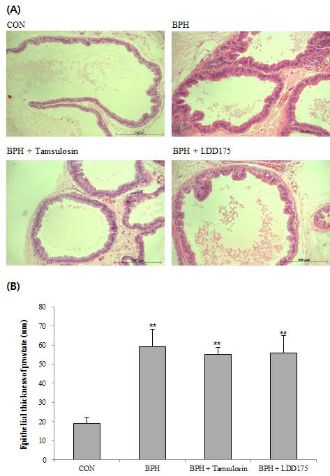 전립선 비대증 동물모델에서 LDD175와 Tamsulosin 투여에 따른 전립선의 조직학적 변화