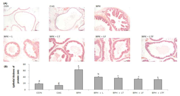 전립선 비대증 동물모델에서 LDD175 와 tamsulosin 또는 finasteride 와의 병용에 따른 전립선의 조직학적 변화