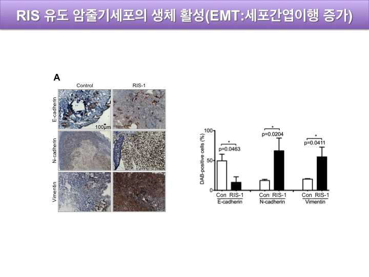 RIS 유도 암 줄기세포에 의한 EMT 증가(생체 내 활정 검증)