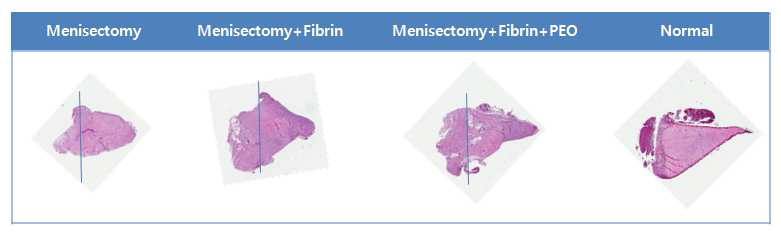 12주째 fibrin, fibrin-PEO를 주입한 그룹에서 재생된 반월상 연골판