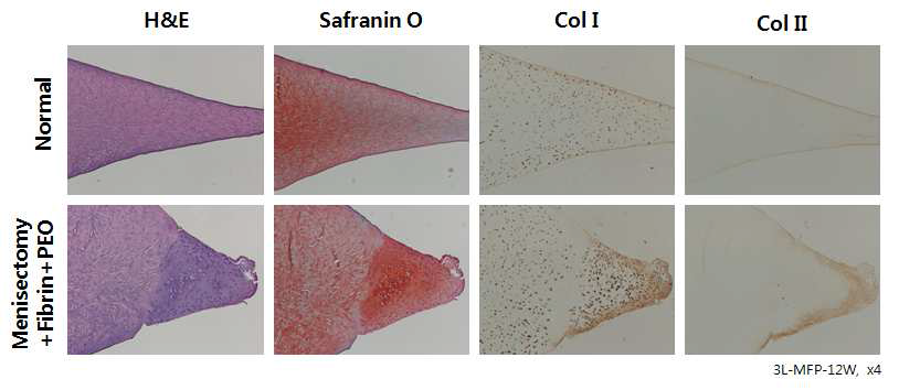fibrin-PEO 주입 후, 4, 8, 12주째 proteoglycan 과 type I, II collagen 의 발현 정도