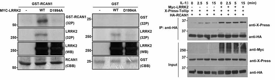 LRRK2에 의한 IL-1Beta 유도 염증신호전달의 양성촉진효과