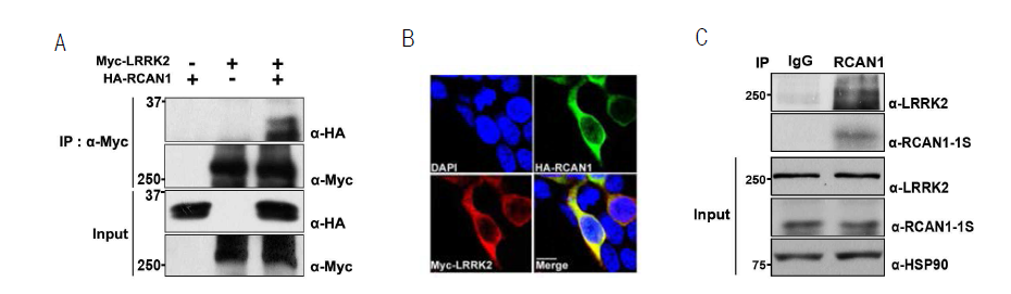 A. Mammalian cell에 LRRK2와 RCAN1 단백을 과 발현시킨 후 면역침전방법을 통해 결합을 확인함. B. 두 단백 항체로 세포를 염색한 후 공초점 현미경을 통해 두 단백의 발현 위치를 조사함. C.쥐의 뇌 조직 내에 존재하는 LRRK2와 RCAN1의 결합을 면역침전법을 통해 확인함.