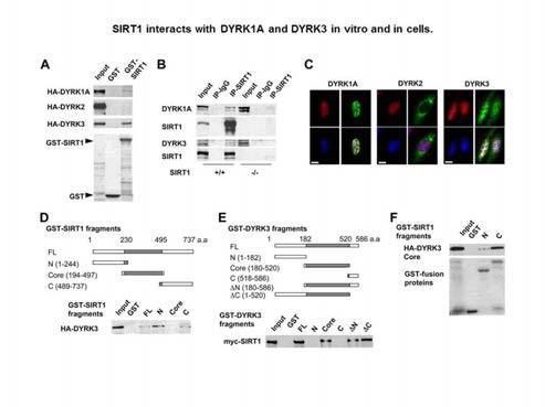 도파민신경세포에서 Dyrk1A와 Sirtuin-1의 단백간 결합 및 결합부위 매핑