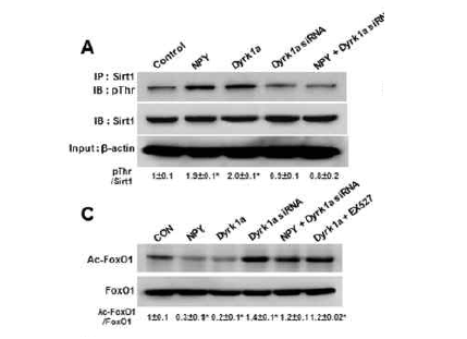 도파민신경세포에서 Dyrk1A-Sirt2-FOXO 신호전달 경로의 연속적인 활성화 확인