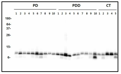 파킨슨병 환자(PD), Parkinson's disease dementia 환자(PDD)와 정상인(CT)의 plamsa를 seed로 사용하여 생성 된 PMCA산물의 PK digestion band pattern 비교.