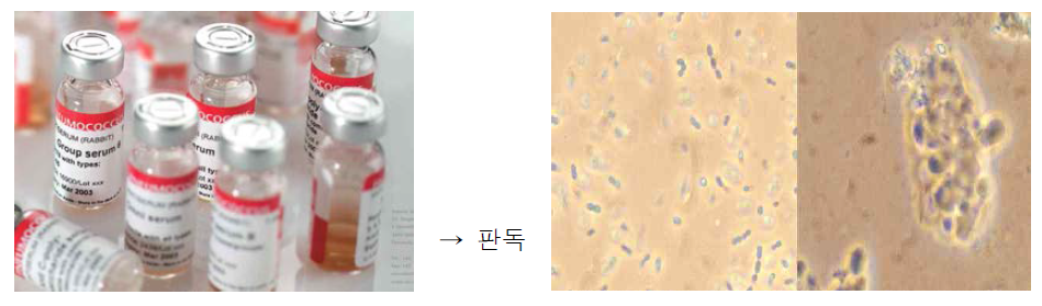 폐렴구균 항혈청 및 육안적 결과 판독