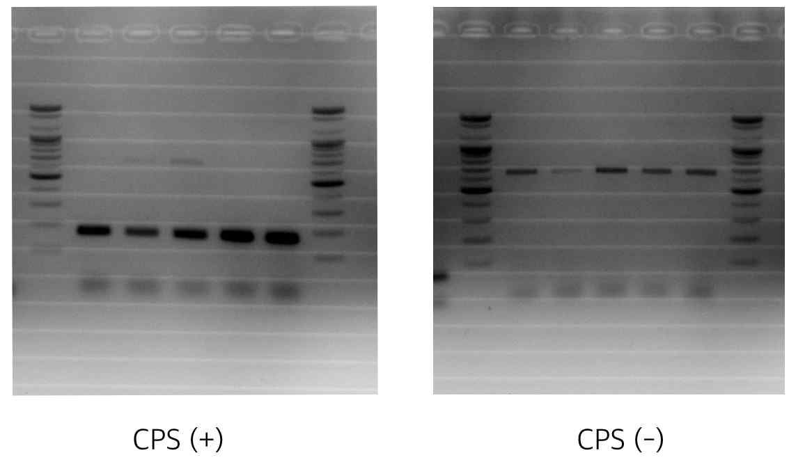 cps의 유무에 따른 35B 프라이머 반응의 차이