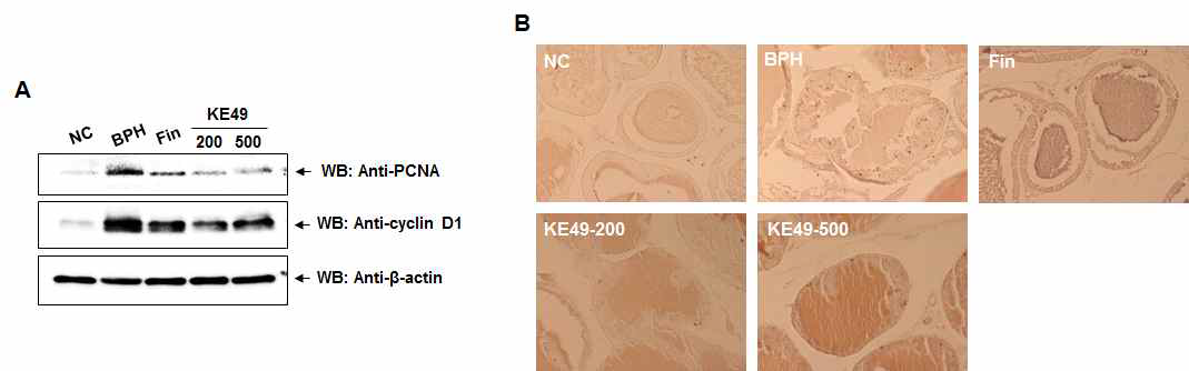 전립선비대증 모델에서 KE49에 의한 전립선 세포증식관련 바이오마커 발현 변화