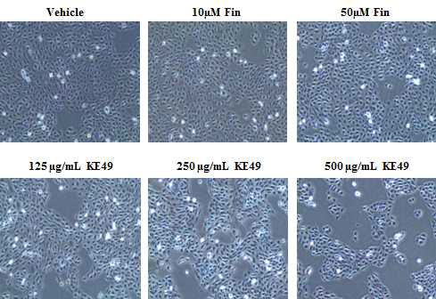 KE49 처방 48시간 처리 후 세포 증식 비교