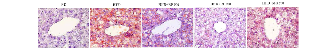 Effect of RP extract on lipid accumulation in liver