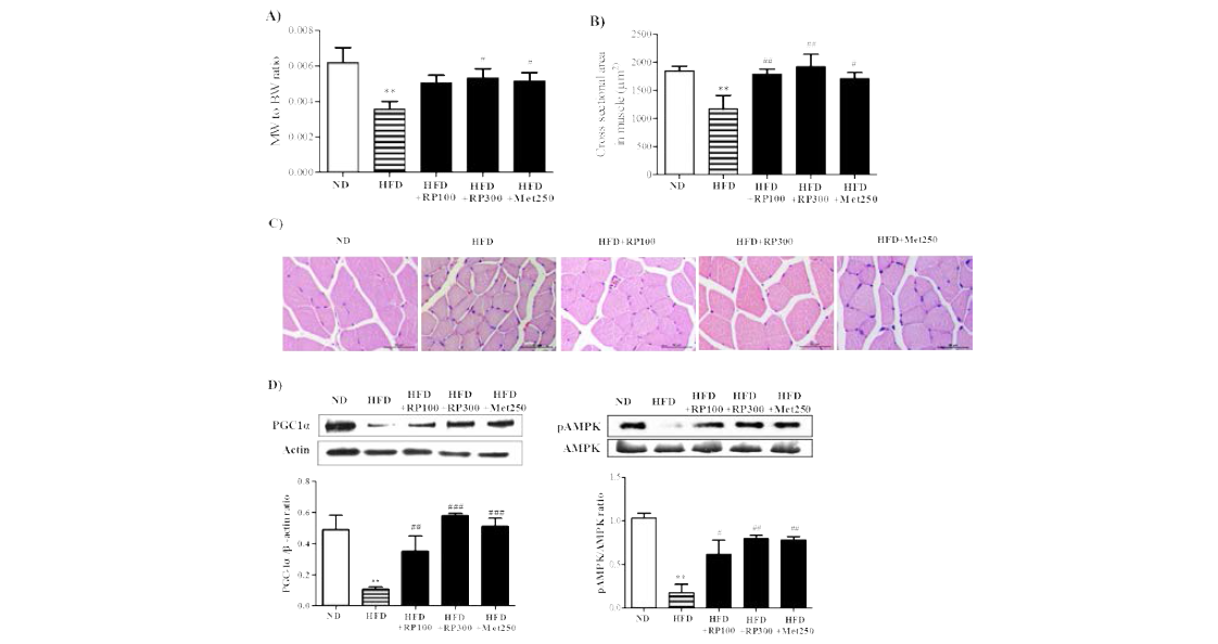 Effect of RP extract on skeletal muscle atrophy and energy metabolism.