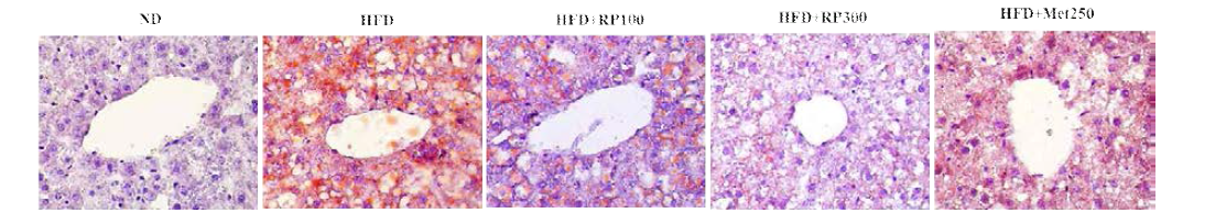 Effect of RP extract on lipid accumulation in liver