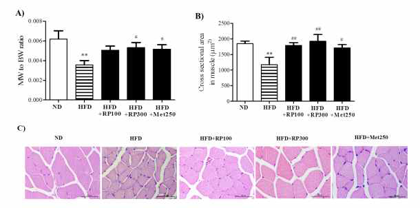 Effect of RP extract on skeletal muscle atrophy and energy metabolism.