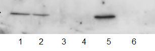 와편모조류 4종, 규조류 2종 으로부터의 추출물에 대한 weatern blot analysis 결과