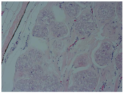 Heterosporis sp.에 감염된 민물장어의 근육조직 (근육내에 원형의 불규칙적인 포자의 시스트가 채워져있다)