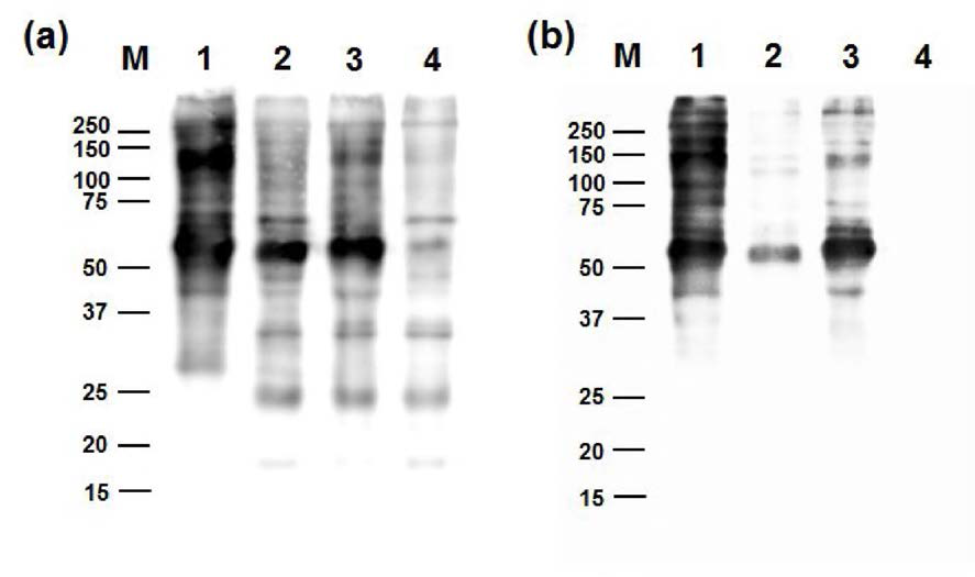 Western blotting을 이용한 난 단백질 항혈청 (anti-serum)과 항체 (anti-IgG)의 특이성 분석