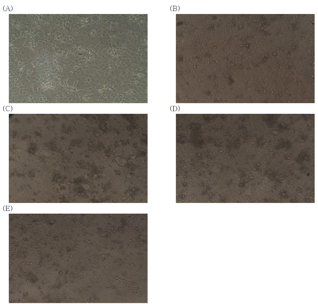 Morphology of CaCO2 cells attached in a 96-well plate (A) or co-cultured with V. parahaemolyticus ATCC 33844 that had been incubated in artificial sea water microcosms (pH6) supplemented with 0.75% NaC l(B), 5% NaCl (C), 10% NaCl (D), and 30% NaCl (E) at 4oC for 35 days