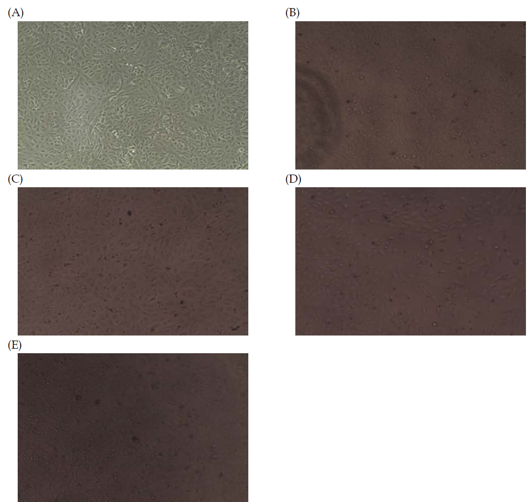 Morphology of Vero cells attached in a 96-well plate (A) or co-cultured with V. parahaemolyticus ATCC 33844 that had been incubated in artificial sea water microcosms (pH6) supplemented with 0.75% NaC l(B), 5% NaCl (C), 10% NaCl (D), and 30% NaCl (E) at 4oC for 35 days